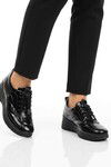 Siyah Rugan Hakiki Deri Anatomik Kadın Casual Ayakkabı 6115 Z